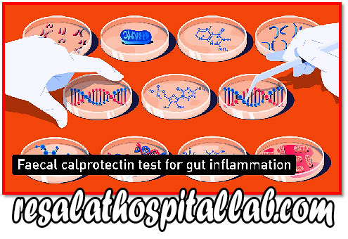 کالپروتکتین |تشخیص التهاب روده|آزمایش calprotectin