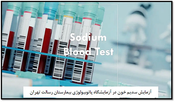 آزمایش سدیم | آزمایش Na خون