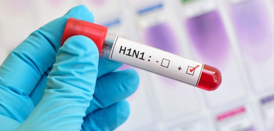 آزمایش تشخیص آنفلوآنزا H1N1